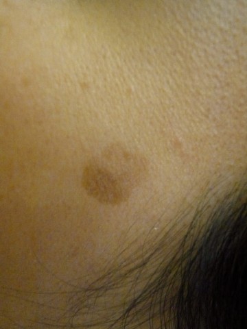 One of my flaws. Ehem, Facial not personality flaw. 